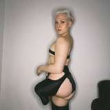 hollyshaleramputee